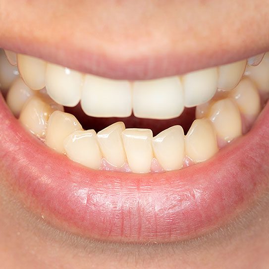 Orthodontics in Dural, NSW