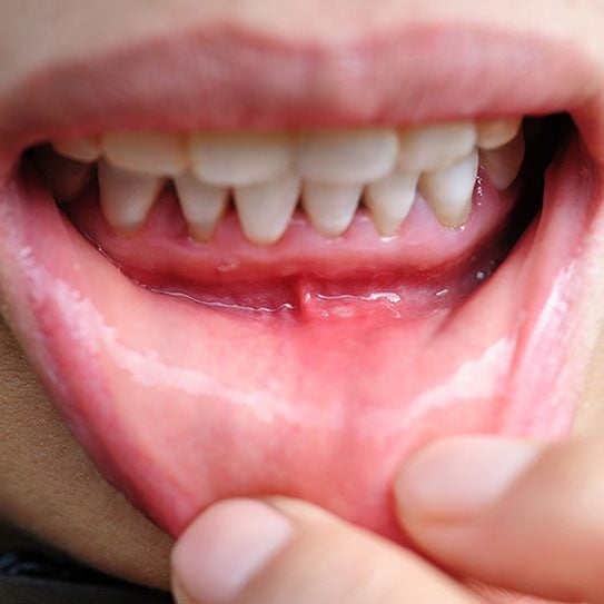 Orthodontics in Dural, NSW